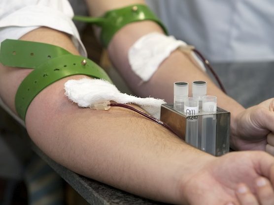 Serosorting Assortative Mating and HIV