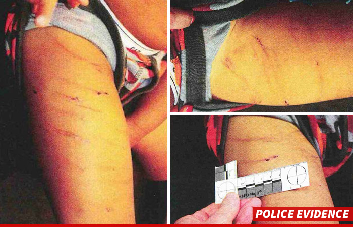 Adrian Peterson Child Abuse Photos