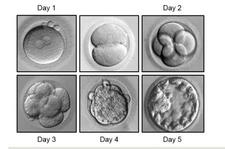 Human Embryo Development